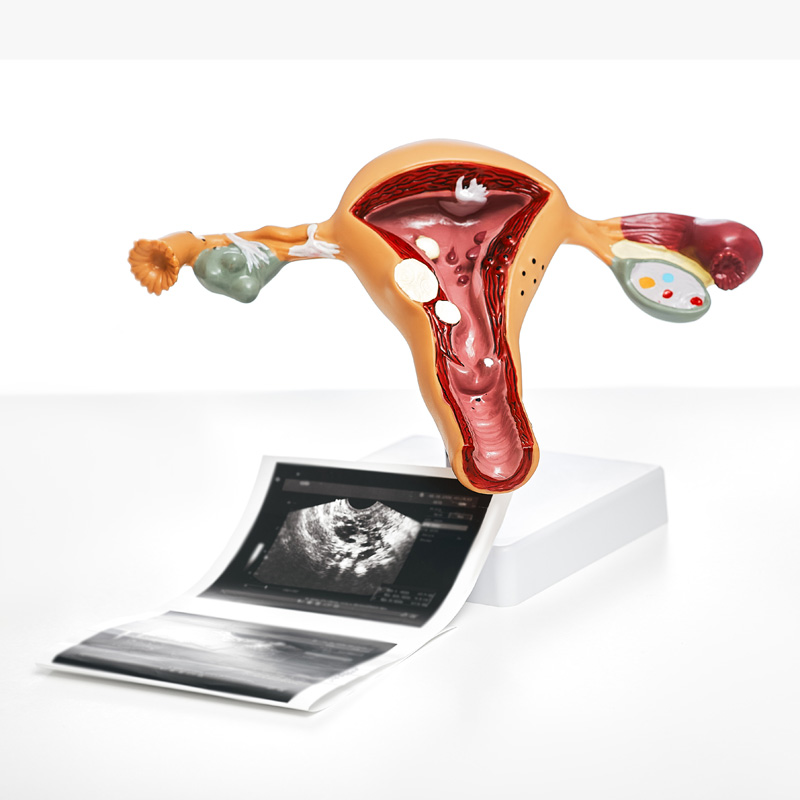 Vaginaler Ultraschall